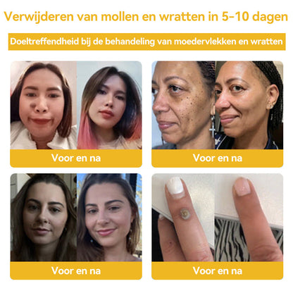𝑭𝑹𝑶𝑷𝑼𝑵™🐝🎁 𝑩𝒊𝒋𝒆𝒏𝒈𝒊𝒇 𝑾𝒓𝒂𝒕𝒕𝒆𝒏 & 𝑴𝒐𝒆𝒅𝒆𝒓𝒗𝒍𝒆𝒌𝒌𝒆𝒏𝑽𝒆𝒓𝒘𝒊𝒋𝒅𝒆𝒓𝒊𝒏𝒈𝒔 𝑪𝒓è𝒎𝒆🔥( 𝑳𝒂𝒂𝒕𝒔𝒕𝒆 𝒅𝒂𝒈 𝒑𝒓𝒐𝒎𝒐𝒕𝒊𝒆 80%0𝒇𝒇）